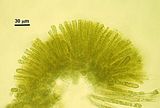 Colpomenia sinuosa6